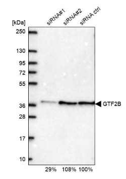 TFIIB Antibody, Novus Biologicals:Antibodies:Primary Antibodies